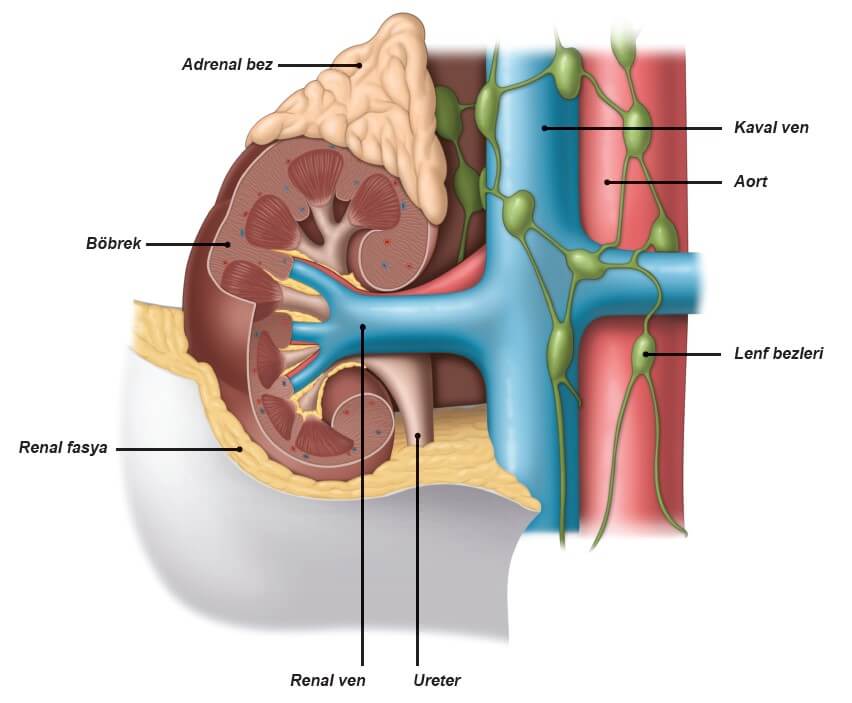 Böbrek Kanseri Nedir